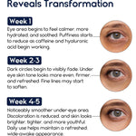 Under Eye Cream for Puffiness and Bags Under Eyes 1 fl oz Eye Bags Treatment for Men Women Anti Wrinkle Cream for Dark Circles Baggy Eyes Treatment for Women with Retinol Hyaluronic Acid & Caffeine